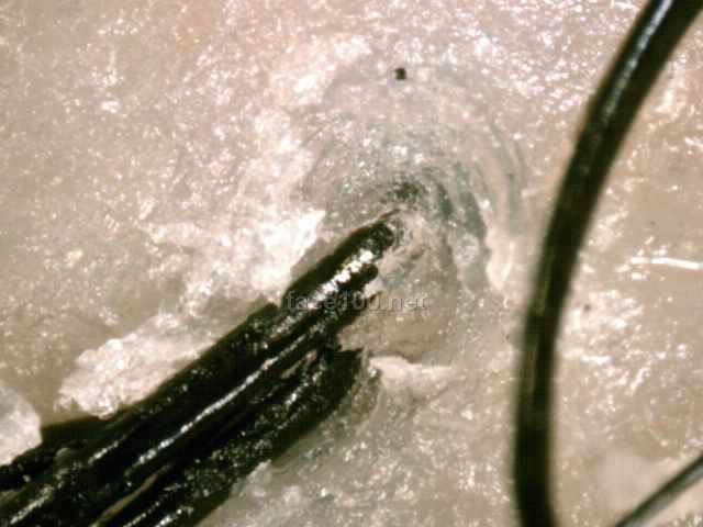 皮肤测试仪器_北京金宏帆商贸有限责任公司_